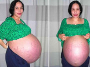 Làm mẹ - Cuộc sống, thân hình hiện tại của “bà mẹ bạch tuộc” xin giống đẻ 14 con từ nhiều đàn ông