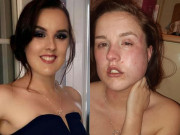 Tin tức - Làm phù dâu trong đám cưới chị gái, cô gái trẻ nhận kết cục vô cùng đau đớn