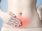 Sức khỏe - U nang buồng trứng phải: Nguyên nhân, cách điều trị và phòng ngừa