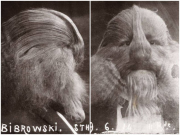 Sự thật người phụ nữ sinh con nửa người nửa thú do nhìn cha bị sư tử tấn công