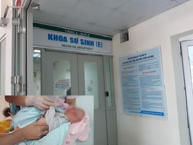 Tin mới về bé sơ sinh bị bỏ dưới hố gas 3 ngày: Vào viện dòi còn trong tai, mắt