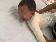 Làm mẹ - Con trai bị bỏng nước sôi, mẹ tưới thêm một thứ được bác sĩ ca ngợi hết lời