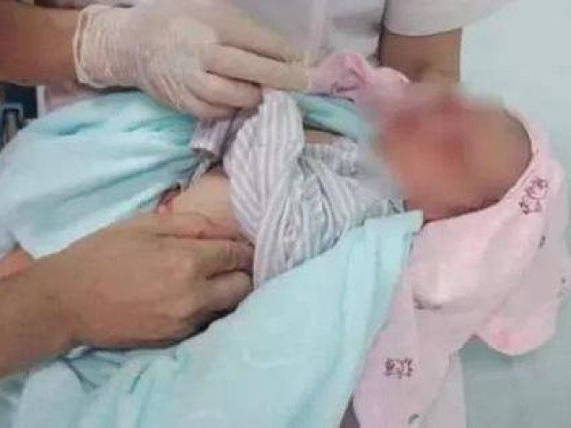 Lý giải sự sống sót kì diệu của em bé bị bỏ rơi 3 ngày giữa trời 40 độ C