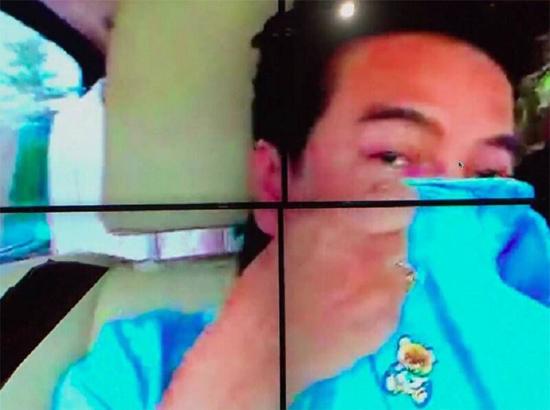 Hồng Ngọc bình phục sau tai nạn bỏng nặng, Đàm Vĩnh Hưng rơi nước mắt - 2