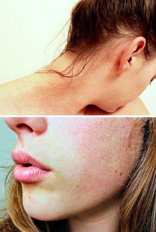 Đi ngủ với mái tóc ẩm, bạn sẽ phải chịu 8 hậu quả chẳng một ai mong muốn này - 7
