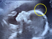 Làm mẹ - Thai nhi siêu âm có dấu hiệu lạ, 4 tháng tuổi đứa trẻ đi đâu cũng có người hâm mộ