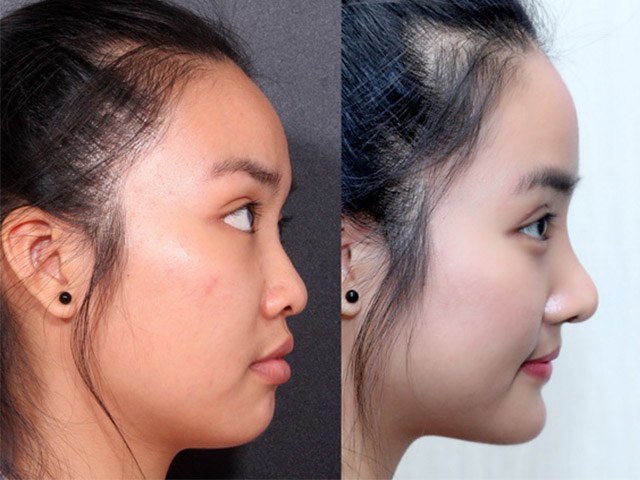 Sở hữu nhan sắc mềm mại, những nữ thần châu Á đích thị là siêu phẩm thẩm mỹ - 14