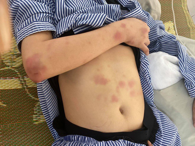 Vụ cô gái bị gã trai xăm trổ đánh dã man: Nạn nhân kể lại 2 giờ kinh hoàng - 1
