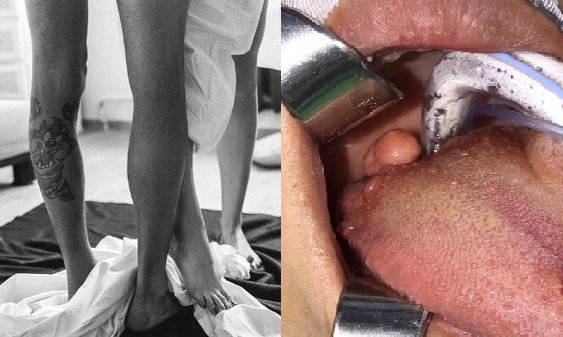 Đang hôn đắm đuối bạn gái, chàng trai bất ngờ đẩy ra, đòi chia tay, cô gái vội đi khám - 1