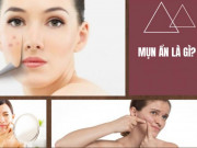 Làm đẹp - 10 cách trị mụn ẩn dưới da tại nhà an toàn hiệu quả nhanh nhất