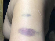 Tin tức - Giáo viên trường quốc tế ở TP.HCM bị tố đánh HS lớp 4 bầm tím tay: Nhà trường lên tiếng