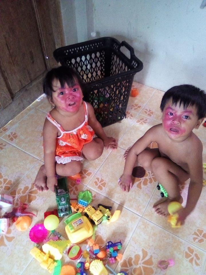 Con khóc nức nở, toàn thân đỏ như máu khiến mẹ hoảng hồn, sự thật vô cùng bất ngờ - 7