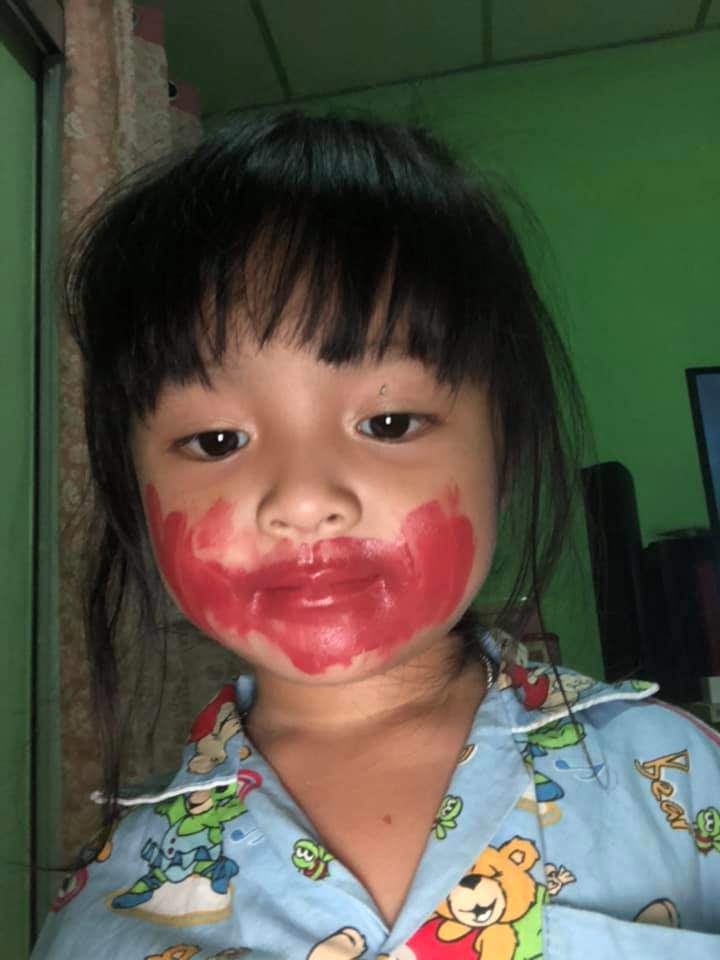 Con khóc nức nở, toàn thân đỏ như máu khiến mẹ hoảng hồn, sự thật vô cùng bất ngờ - 10