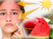 Sức khỏe - Ăn ngay 5 loại rau quả này tốt chẳng kém kem chống nắng, ngừa tia UV lẫn ung thư da