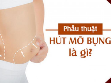 Hút mỡ bụng và những sai lầm biến chứng thường gặp dẫn đến tử vong