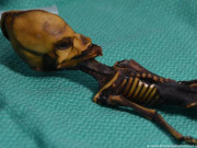 Sức khỏe - Bí ẩn xác ướp người ngoài hành tinh sau 15 năm mới hé mở câu chuyện đau lòng phía sau