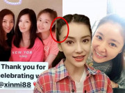 Làm đẹp - Hết bị soi mặt mộc già nua, Lâm Tâm Như để lộ đầu hói trán giống hệt Angela Baby