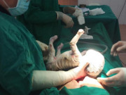 Bà bầu - Mẹ bầu Yên Bái 15 tuổi sinh con, em bé toàn thân bọc vảy trắng cùng nhiều vết nứt