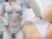 Làm đẹp - Chăm sóc da sau triệt lông bikini, chuyện quan trọng nhưng ít ai để tâm
