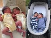 Tin tức - Người mẹ mang thai 3 tuần phát hiện có bầu thêm, 2 bé lệch cân nặng khiến ai cũng sốc