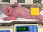 Tin tức - Em bé chào đời nặng 6,5 kg, hình ảnh hiện tại gây bất ngờ không kém