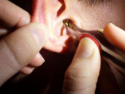 Sức khỏe - Đừng coi thường 6 biểu hiện này ở ráy tai, có thể cảnh báo cơ thể có vấn đề