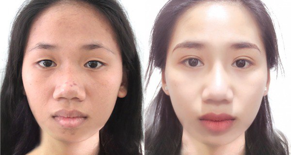 Bị đồn mở góc mắt, cắt mí, Châu Bùi đáp trả khéo léo đầy thuyết phục - 13