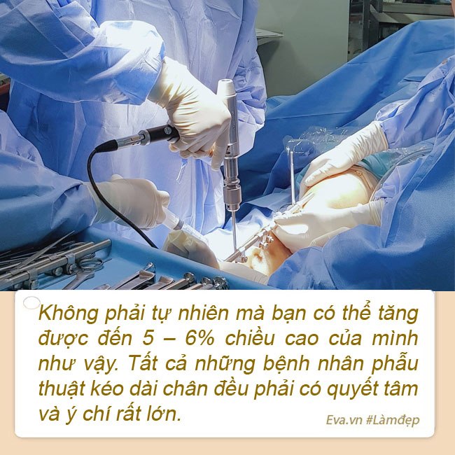 Chi hơn 5 tỷ kéo chân, Khoa Pug cao từ 1m67 lên 1m80 mà không cần đeo amp;#34;giáp sắtamp;#34; - 13