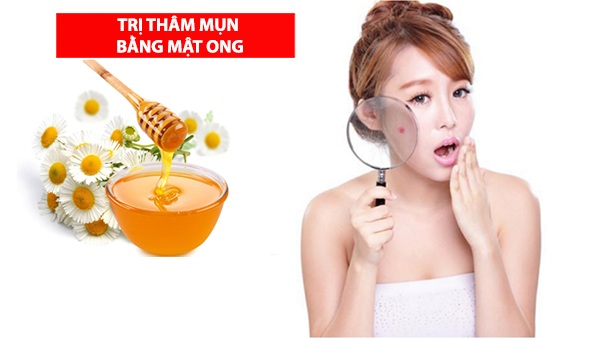 Cách trị thâm mụn tại nhà nhanh nhất an toàn và dễ dàng thực hiện - 1