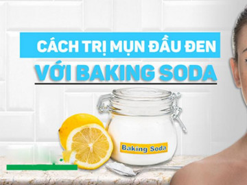 Cách trị mụn đầu đen tại nhà hiệu quả để có làn da trắng sáng mịn màng