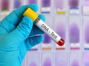 Tin tức - Đi xét nghiệm ADN cho 3 đứa con, chồng phát hiện bí mật vợ giấu kín bấy lâu nay