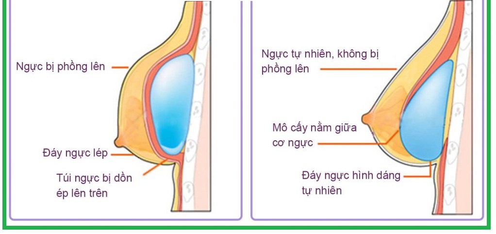 Mỹ nhân quyến rũ nhất amp;#34;Về nhà đi conamp;#34; khoe dáng với bikini, vòng 1 dao kéo nổi bật - 7