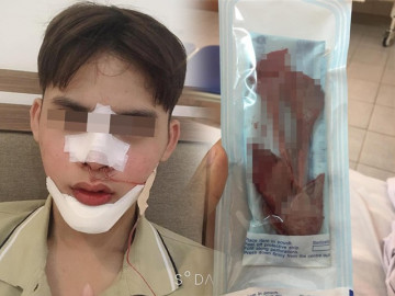 Nam thanh niên lột xác sau 2 năm gọt hàm, hết hồn với chiến tích cầm về năm nào