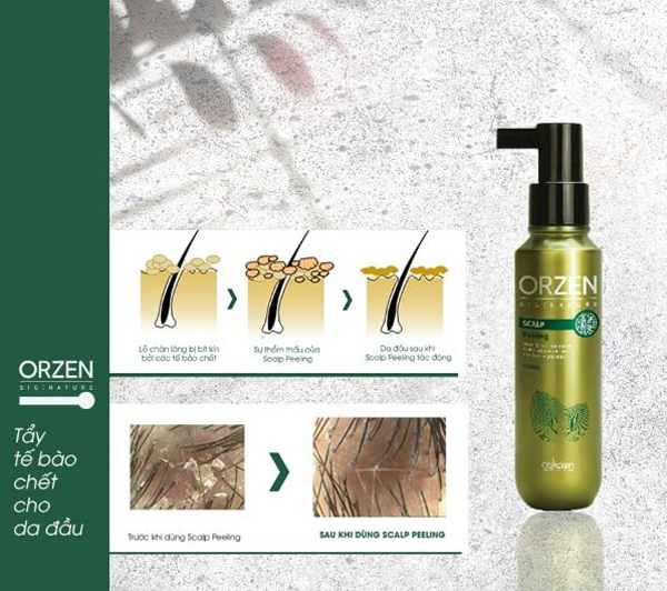Cách giữ mái tóc khỏe đẹp cùng tẩy tế bào chết da đầu Orzen Signature - 2
