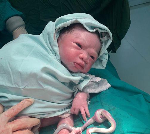 Mẹ bầu trẻ Tuyên Quang nhập viện cấp cứu, nhìn dây rốn bé bác sĩ nói: amp;#34;Là ca hy hữuamp;#34; - 1