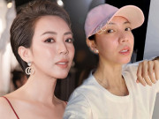 Làm đẹp - Thu Trang tiêm mỡ lên mặt, giờ trẻ đẹp đúng chuẩn Hoa hậu làng hài 