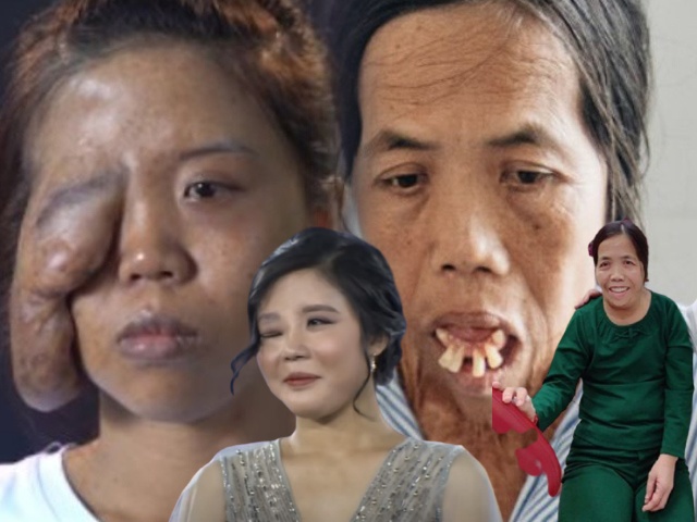 Những người phụ nữ mang mặt quỷ hóa thiên thần nhờ phẫu thuật thẩm mỹ