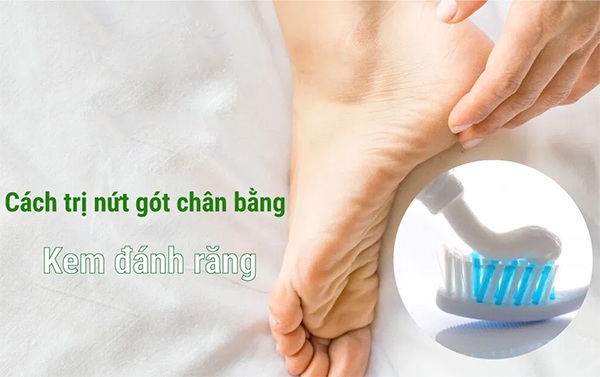 10 Cách trị nứt gót chân tại nhà tự nhiên an toàn hiệu quả nhanh nhất - 3