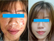 Làm đẹp mỗi ngày - Kem trộn – lối thoát nào cho người tiêu dùng?