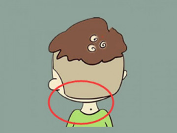 5 nốt ruồi báo hiệu cuộc đời đổi vận nhờ quý nhân, giàu sang bất chấp