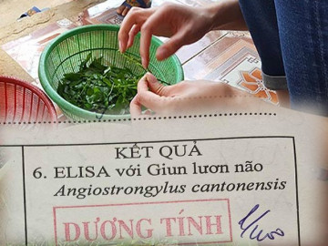 Nữ doanh nhân bị giun não dù ăn uống sạch, chuyên gia cảnh báo nhặt rau cũng có thể nhiễm