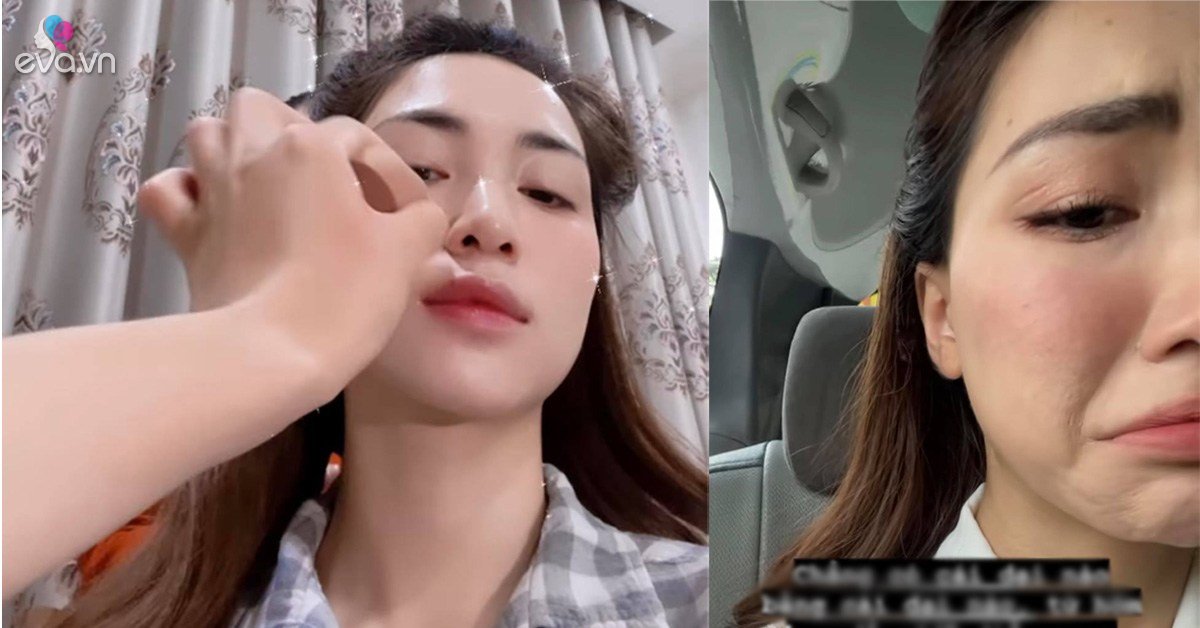 Hòa Minzy khóc ròng khi mặt bong tróc từng mảng nhăn nheo như bà già