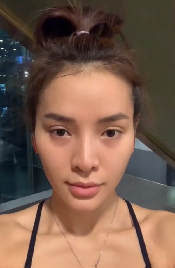 Phương Trinh Jolie tự tay tiêm thon mặt mà dân mạng phải choáng theo - 15
