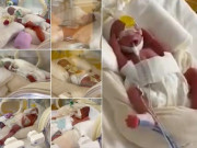 Tin tức - Sản phụ "đẻ sòn sòn" 9 đứa con, không ai tin nổi vì siêu âm chỉ có 7 đứa