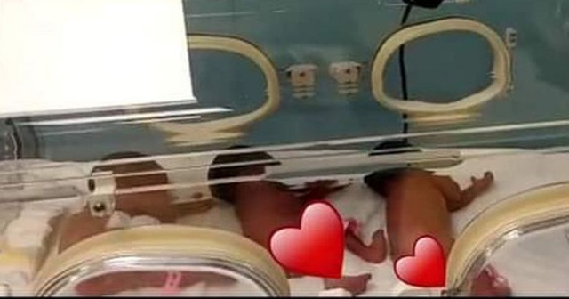 Sản phụ và bác sĩ đều sốc với ca sinh 9 trong khi siêu âm chỉ có 7 con - 3