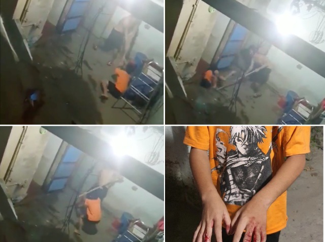 Phẫn nộ clip bé trai bị đánh nát tay, bắt đi bán vé số: Lời kể của hàng xóm - 1