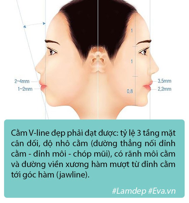 Độn cằm là phương pháp PTTM rất đơn giản nhưng tại sao vẫn có nhiều ca biến chứng? - 2