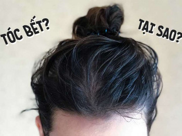 Bách khoa toàn thư trị tóc bết dầu ngày nóng như đổ lửa