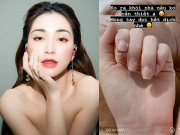 Làm đẹp - Nhìn móng tay Hoà Minzy cụt lủn, bong tróc thấy thương nhưng lí do ai nấy đều đồng cảm