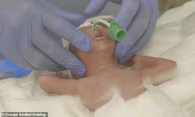 Hình ảnh mới nhất về 9 em bé trong ca sinh 9 gây chấn động thế giới những ngày qua - 5